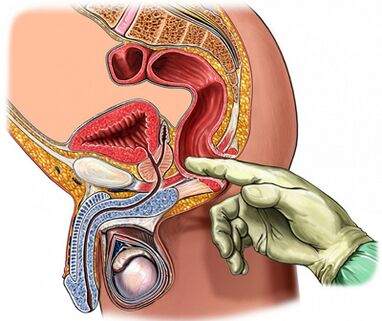 Digitale Prostatauntersuchung