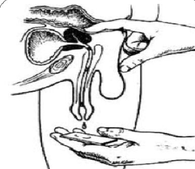 Massieren Sie die Prostata, um Sekrete zu erhalten